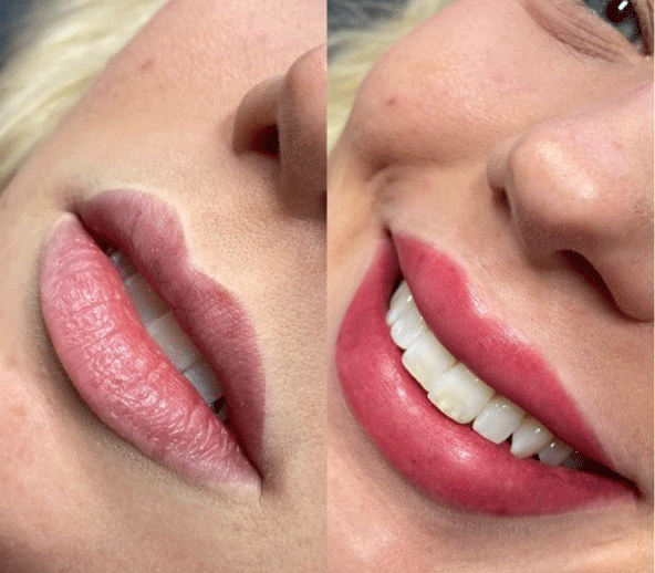 Lip blush before and after