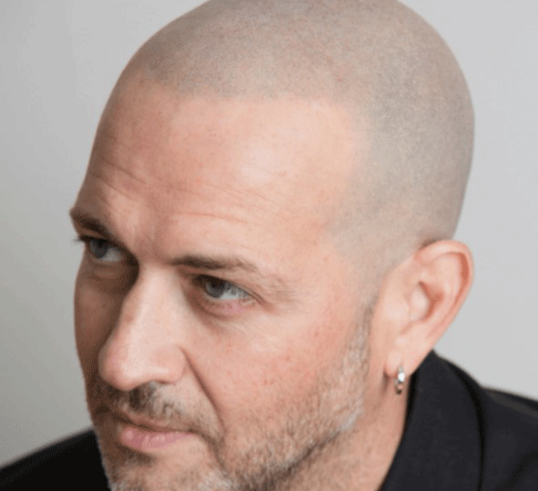 Bald head image