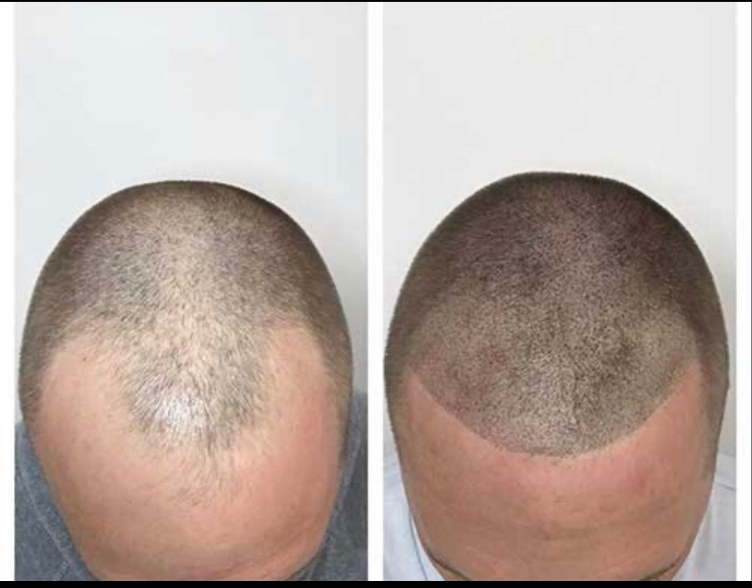 Before after image